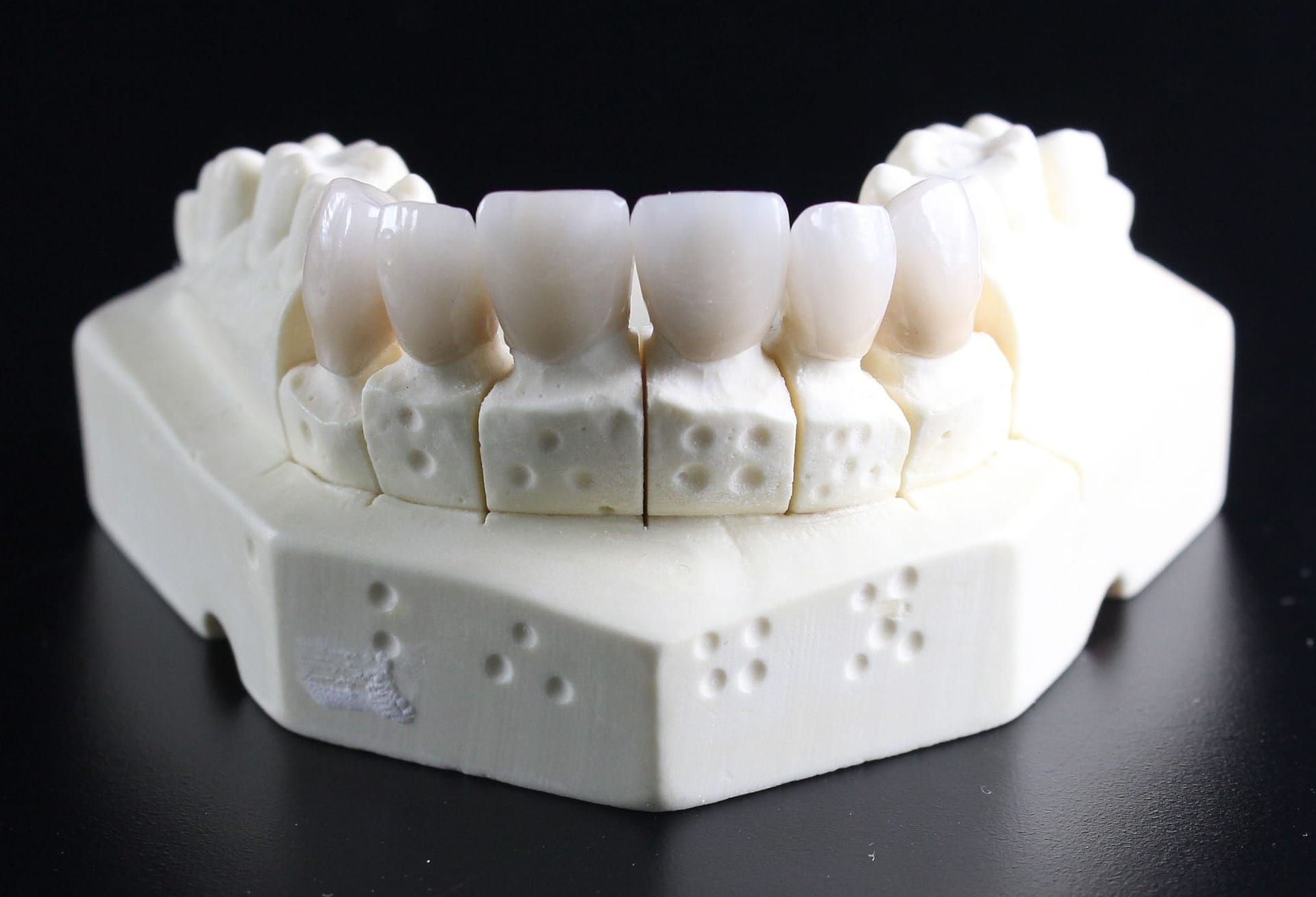 What is a dental crown